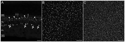 Prox1 Is a Marker for AII Amacrine Cells in the Mouse Retina